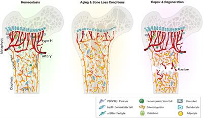 Bone Angiogenesis and Vascular Niche Remodeling in Stress, Aging, and Diseases